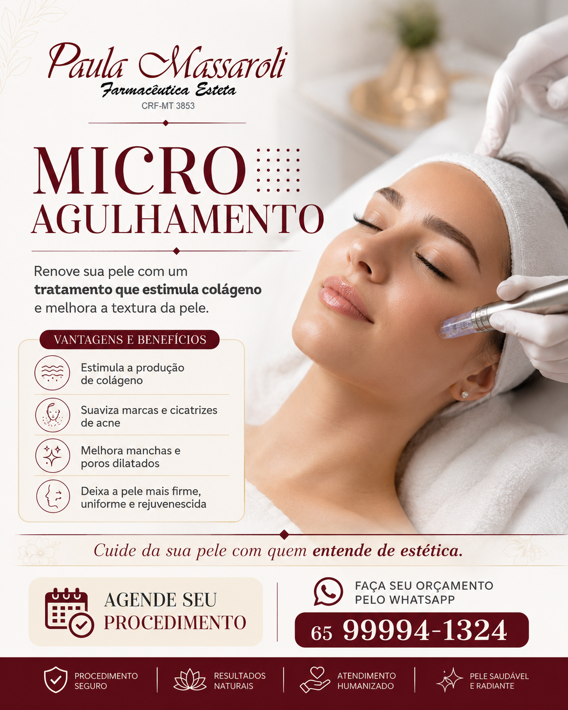 Microagulhamento Facial Cuiabá